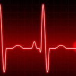 ecg