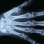 Radiography