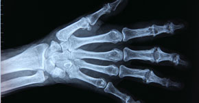 Radiography