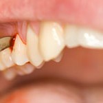 dental treatment