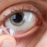 Application of contact lens