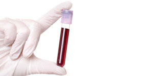 hand holding blood in test tube close up