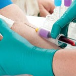 donación de sangre. trasplantes. donan sangre