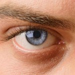 glaucoma, selfies, tratamiento de la diabetes , edema macular diabético