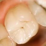 pacientes diabéticos. diabetes, cuidado bucodental