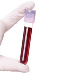 análisis de sangre. donación de sangre, donar sangre