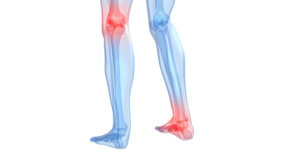 tratamiento de la artrosis de rodilla