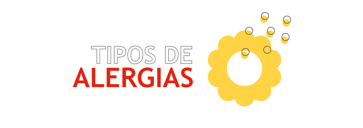 sla_jh_itps_infografia_alergenos_10052017_002-facebook